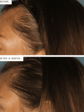 Load image into Gallery viewer, Hair Growth Supplement for Women 3mo Supply