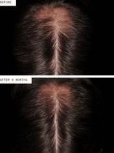 Load image into Gallery viewer, Hair Growth Supplement for Men 3mo Supply