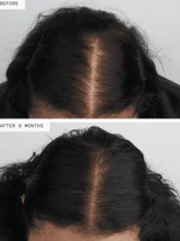 Load image into Gallery viewer, Hair Growth Supplement Women's Balance 3mo Supply
