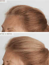 Load image into Gallery viewer, Hair Growth Supplement Women's Balance 3mo Supply