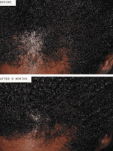 Load image into Gallery viewer, Hair Growth Supplement for Women 3mo Supply