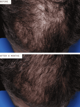 Load image into Gallery viewer, Hair Growth Supplement for Men 3mo Supply