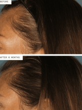 Load image into Gallery viewer, Hair Growth Supplement for Women 3mo Supply
