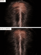 Load image into Gallery viewer, Hair Growth Supplement for Men 3mo Supply
