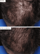 Load image into Gallery viewer, Hair Growth Supplement for Men 3mo Supply
